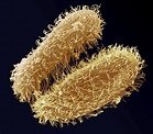 Ciliate Protozoa, Sem Photograph by Steve Gschmeissner