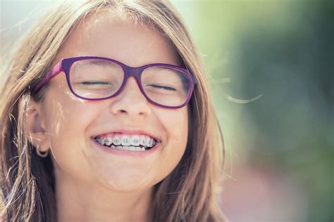 Top 10 Braces Questions And Answers Tender Smiles 4 Kids