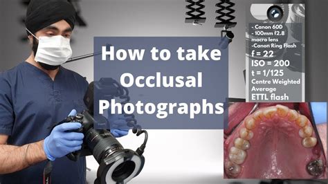 How I Take Occlusal Dental Photographs On My Patients Dental Tutorial