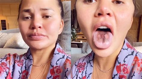 Chrissy Teigen Is Eating So Much Sour Candy That Her Tongue Is Falling