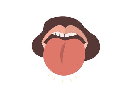 Manhattan Verzeichnis Witzig Woke Up With Swollen Tongue On One Side