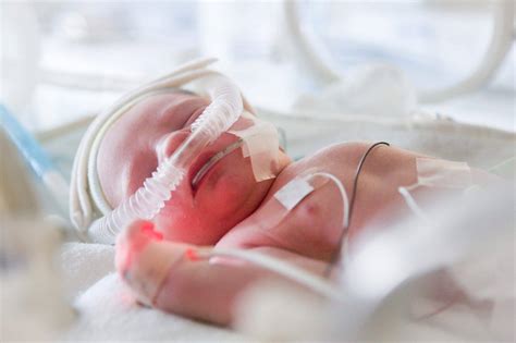 One Time Preemie Now A Neonatal Physician Treating Infants With