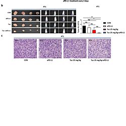 Additional File 3 Of Optimized Dose Selective HDAC Inhibitor