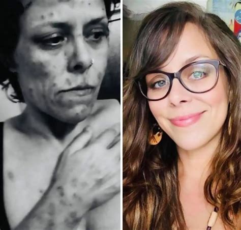 ‘the Addicts Diary Showcases Before And After Transformations Of People