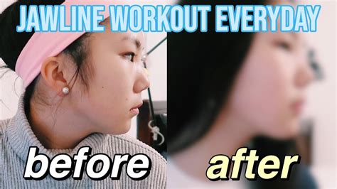 I Did A 10 Minute Jawline Workout Everyday For 30 Days Shocking Youtube