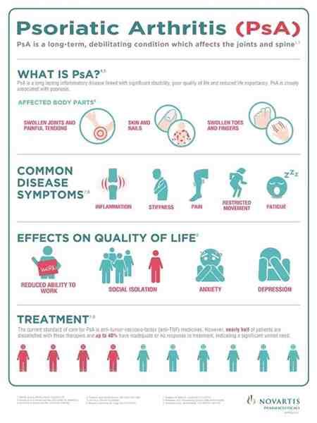 Psoriatic Arthritis Statistics Uk Natural Remedies ~ Dcss