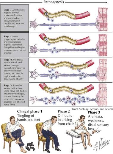 Neuromuscular Disorders Clinical Gate