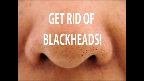 Gently massage onto your nose to loosen up the skin and unclog the pores. HOW TO GET RID OF BLACKHEADS! DIY BLACKHEAD TREATMENT ...