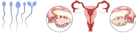 Ivf Centre Murni Teguh Memorial Hospital