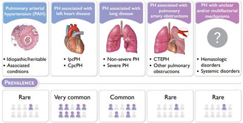Revised Definition Of Pulmonary Hypertension And Approach To Management