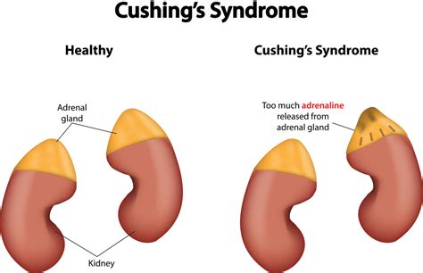 Cushings Disease What Animals Are At Risk And What Are The Signs