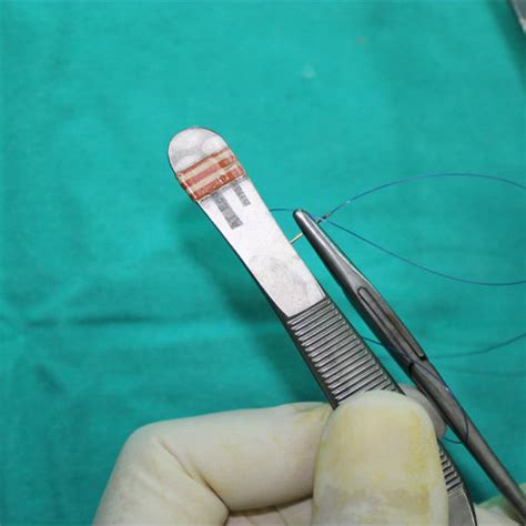 The Straightened Needle And The Distal End Of The Suture Are Threaded