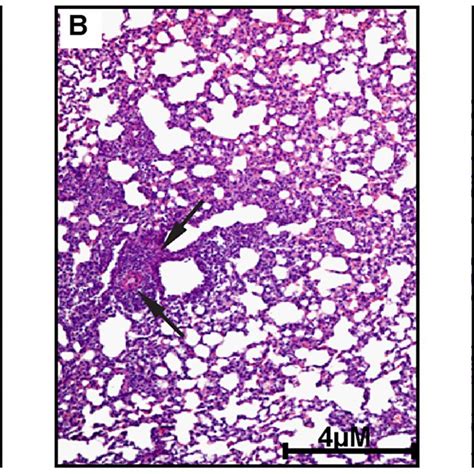 Histopathology Of Lung Tissues After 2 Aa Treatment A Control
