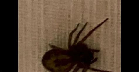 Spider Bites While Sleeping Woman Undergoes Surgery After Venomous