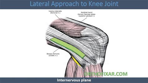 Lateral Approach To Knee Joint 2023 Orthofixar