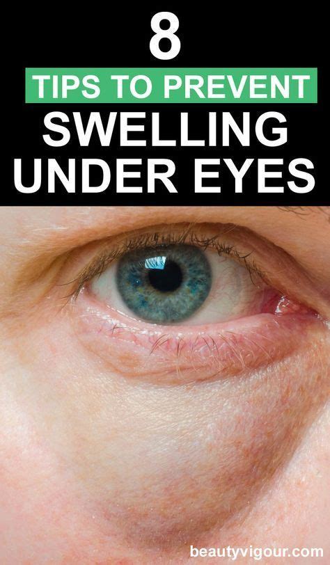 8 Tips To Prevent Swelling Under Eye Prevent Swelling Undereye Eye Care