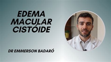 Edema Macular Cist Ide Dr Emmerson Badar Youtube