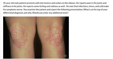 Solved 45 Year Old Male Patient Presents With Skin Lesions And