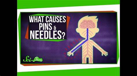 What Causes Pins And Needles Youtube