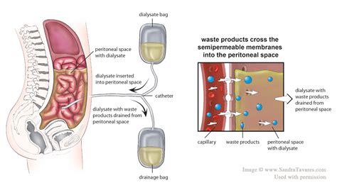 Peritoneal Dialysis Membrane