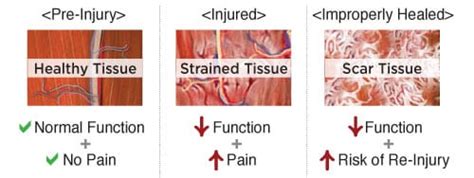 O Que Significa Scar Tissue Askbrain