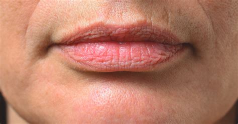 Layer of fat molecules (oil) from the skin that normally. Smoker's Lips: Why You Get Them, How You Can Make Them Go Away