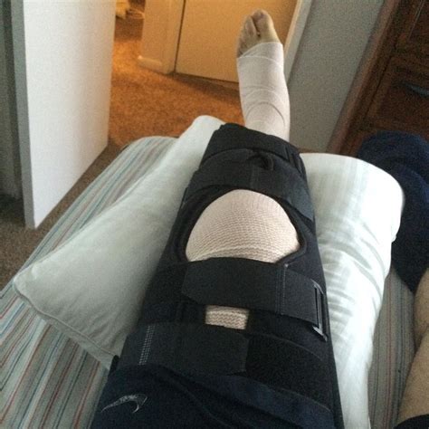 Acl Reconstruction Successfully Done Thanks To My Doctor Flickr