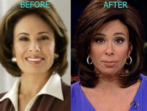 Jeanine Pirro Plastic Surgery Before And After Photos Celeblens Com