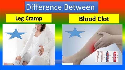 Difference Between Leg Cramp And Blood Clot In Pregnancy Youtube