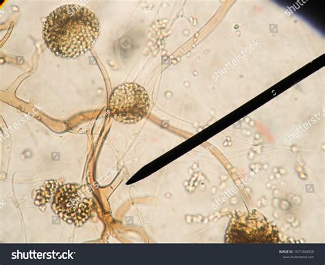 Rhizopus Microscope