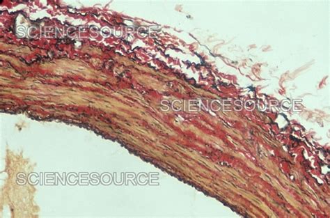 Photograph Transverse Section Of Vein Wall Science Source Images