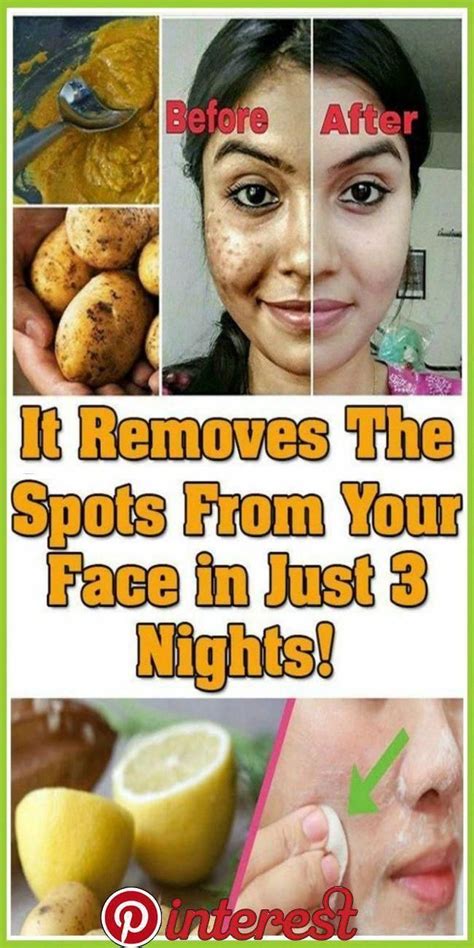 The Best Way To Eliminate Dark Spots From Facial Area Within Two Times