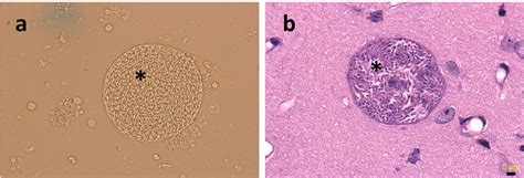 T Gondii Tissue Cyst Containing Bradyzoites Obtained From Mice