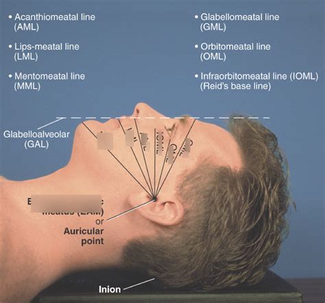 Skull Positioning Lines Diagram Quizlet