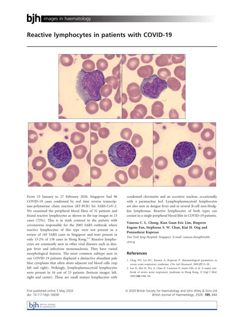 Pdf Reactive Lymphocytes In Patients With Covid 19