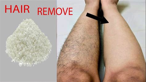 How To Easily Remove Legs Hair Using Alum Youtube