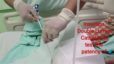 Subclavian Dialysis Catheter