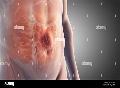 Abdominal Hernia Hi Res Stock Photography And Images Alamy