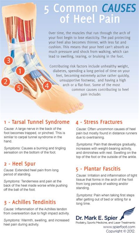 Foot Pain Diagram