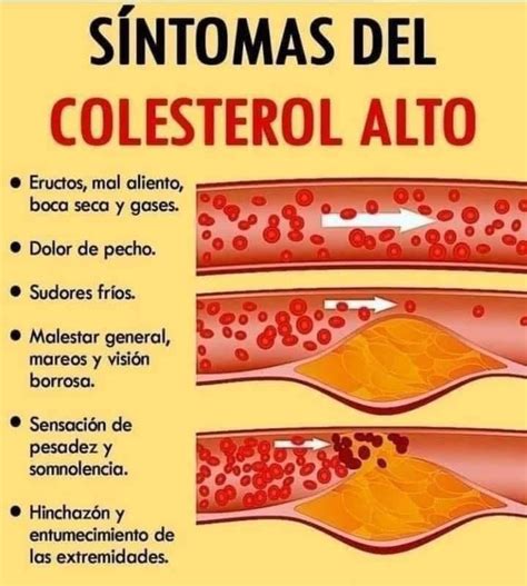 Sintomas Y Consecuencias De Tener Colesterol Alto Nutricion Vitae