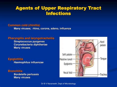 ppt respiratory tract infections rti powerpoint presentation free download id 1451151