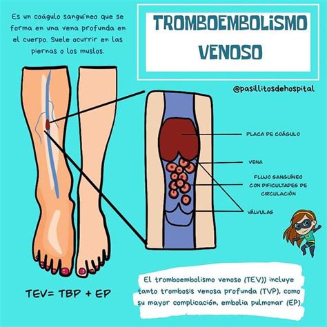 Pasillitos De Hospital En Instagram Tromboembolismo Venoso