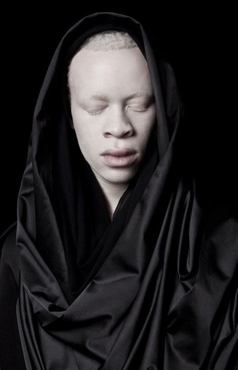 In Pictures Albinism And Perceptions Of Beauty Albino Model