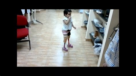 5 Years Old Akbk Amputee First Steps With Prosthetics Youtube