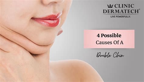 5 Ways To Double Chin Reduction Article Ring