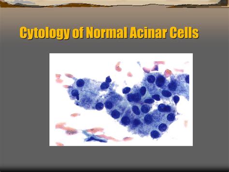 Ppt Fna Of The Pancreas Powerpoint Presentation Id376099
