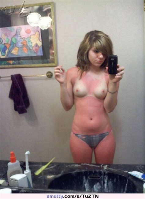 Selfie Topless Topless Bikini Sunburn Ouch Smutty