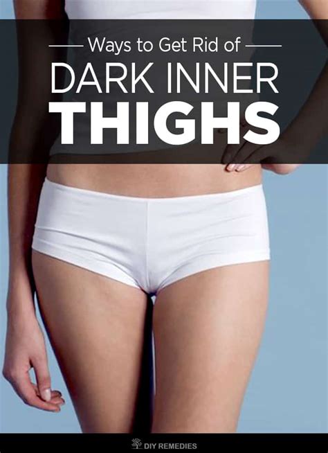 8 Best Ways To Get Rid Of Dark Inner Thighs
