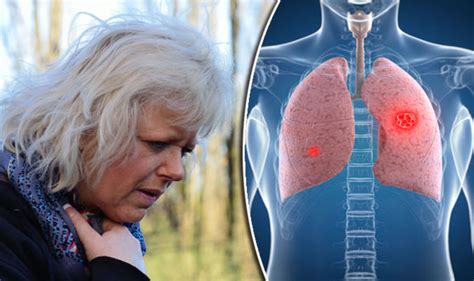 Lung Cancer Symptoms Coughing And Breathlessness Major Signs