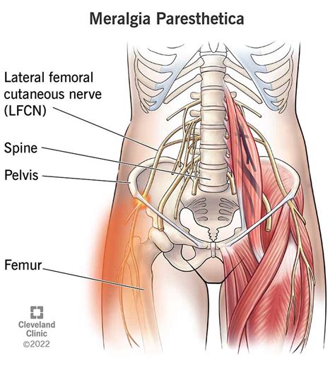 Anterior Lateral Femoral Cutaneous Nerve My XXX Hot Girl